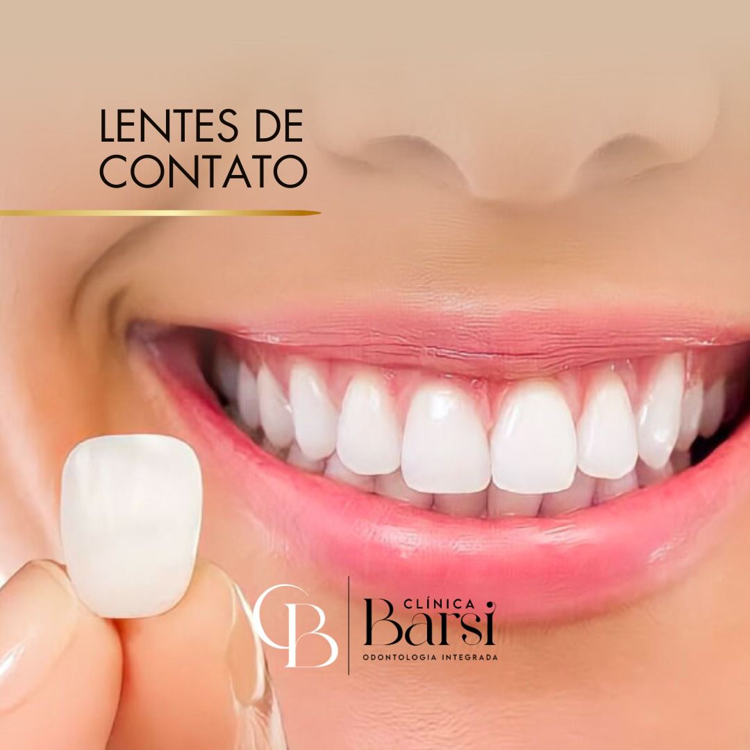 Lentes de Contato Dental